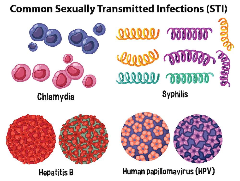 Vanliga sexuellt överförbara infektioner (STI)